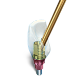 Sec2-PP-SMARTbase